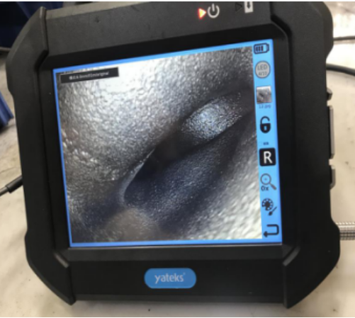 电子内窥镜5点优于纤维内窥镜